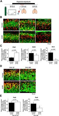 Impaired Cell Cycle Progression and Self-Renewal of Fetal Neural Stem and Progenitor Cells in a Murine Model of Intrauterine Growth Restriction